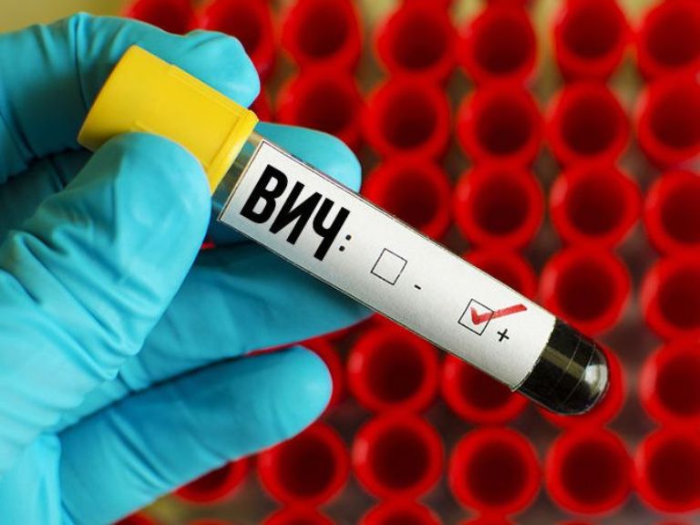 Неутешительная статистика: в Запорожской области количество больных СПИДом увеличилось на 14%