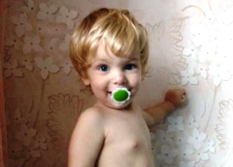 «Открыл глаз и закричал от радости»: в Запорожье 2-летний ребенок, которого ошпарило кипятком, пришел в себя