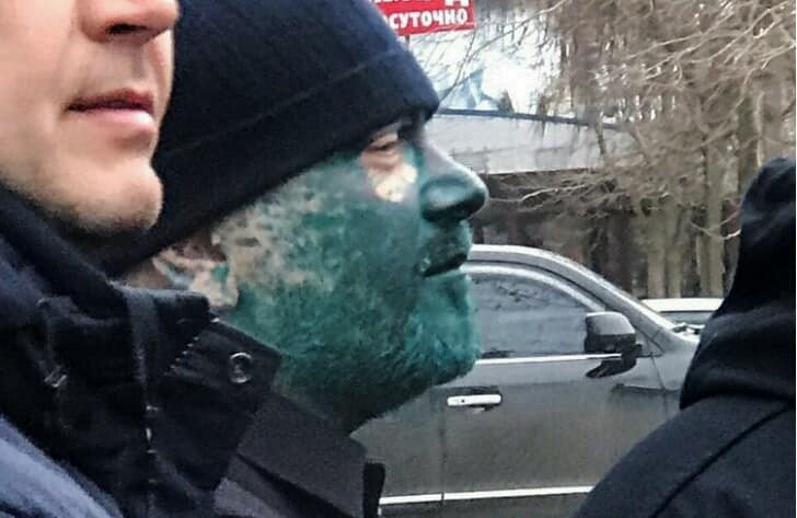 Мужчине, облившего Вилкула зеленкой, грозит наказание за хулиганство (ФОТО)