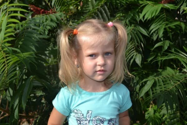 4 месяца в коме: в Запорожье пытаются спасти 3-летнюю девочку, которая подавилась черешней