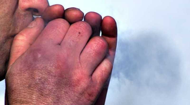 В Запорожской области умер мужчина от переохлаждения