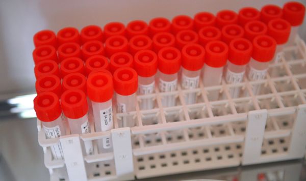 16 заболевших: в Запорожье вспышка COVID-19 общежитии университета, — СМИ