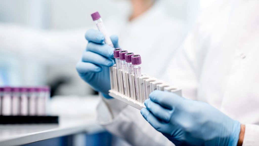 В Запорожской области снова более 1000 случаев COVID-19