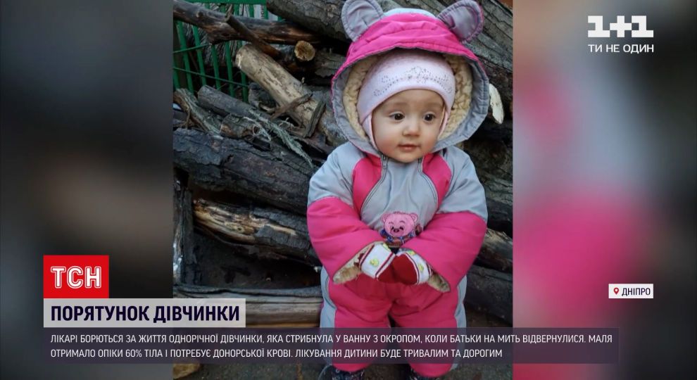 60% ожогов: стало известно о состоянии  малышки, которую спасали врачи Днепра