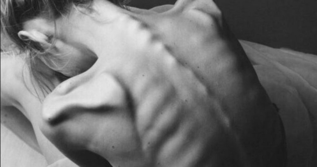 12-летняя девочка умерла от анорексии: школьница пыталась похудеть в Одессе