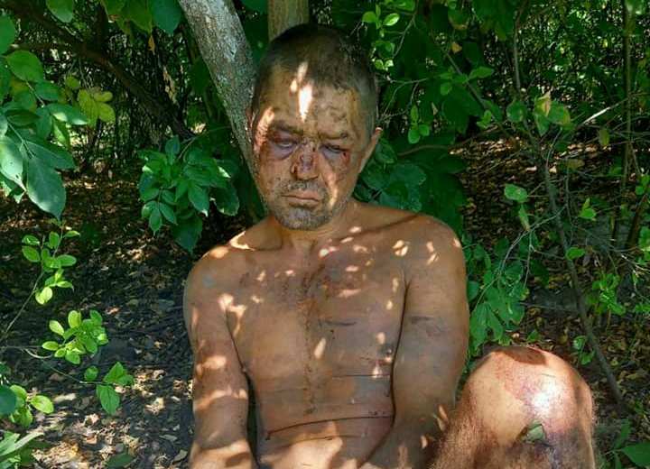 Привязывали цепями к авто и обещали утопить: под Запорожьем жестоко пытали мужчину (ФОТО)