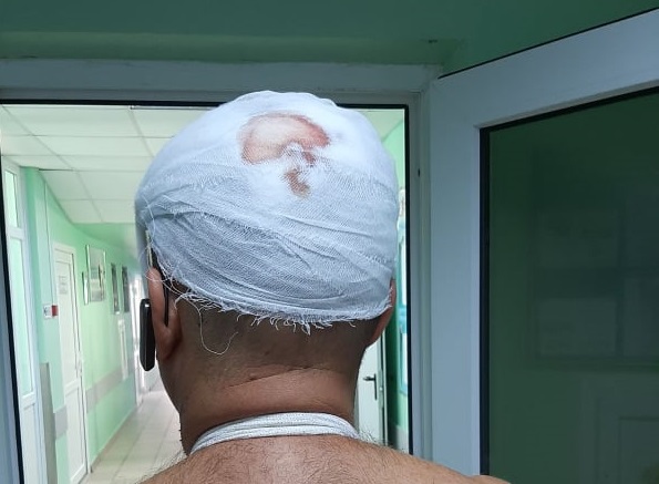 По факту избиения профсоюзного лидера железнодорожников в Запорожье открыто уголовное производство