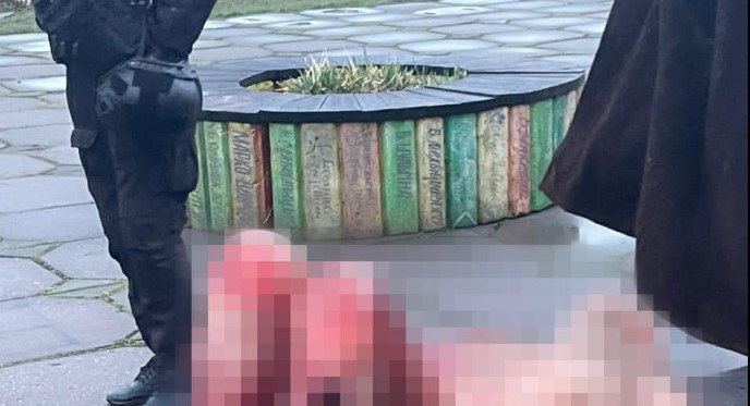 У Запоріжжі зграя собак напала на чоловіка (ФОТО)