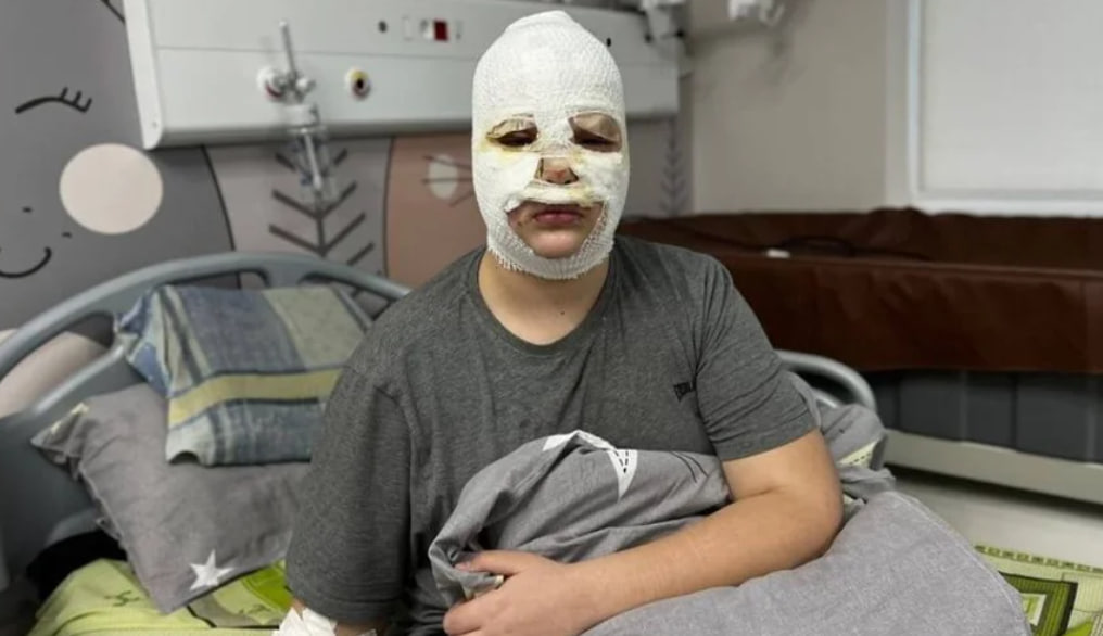 Дітей та їхніх батьків попереджають про небезпечний челендж з виготовленням саморобних петард